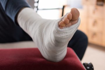 ankle ligament surgery